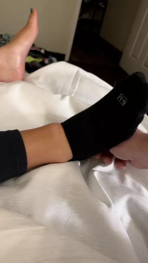 My wife’s swollen ankle after twisting it in tennis shoes and cute smelly ankle socks by Wifesfeet2admire