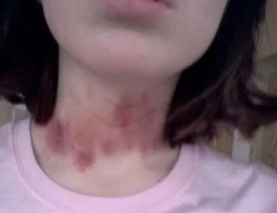 Natural collar 😻 posted by HereItIsMee