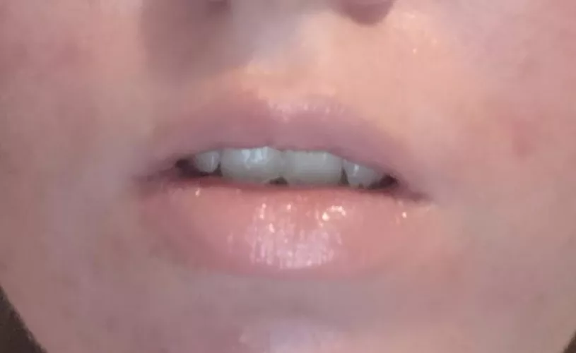 natural lips, do they need fillers? by pigdollyslave