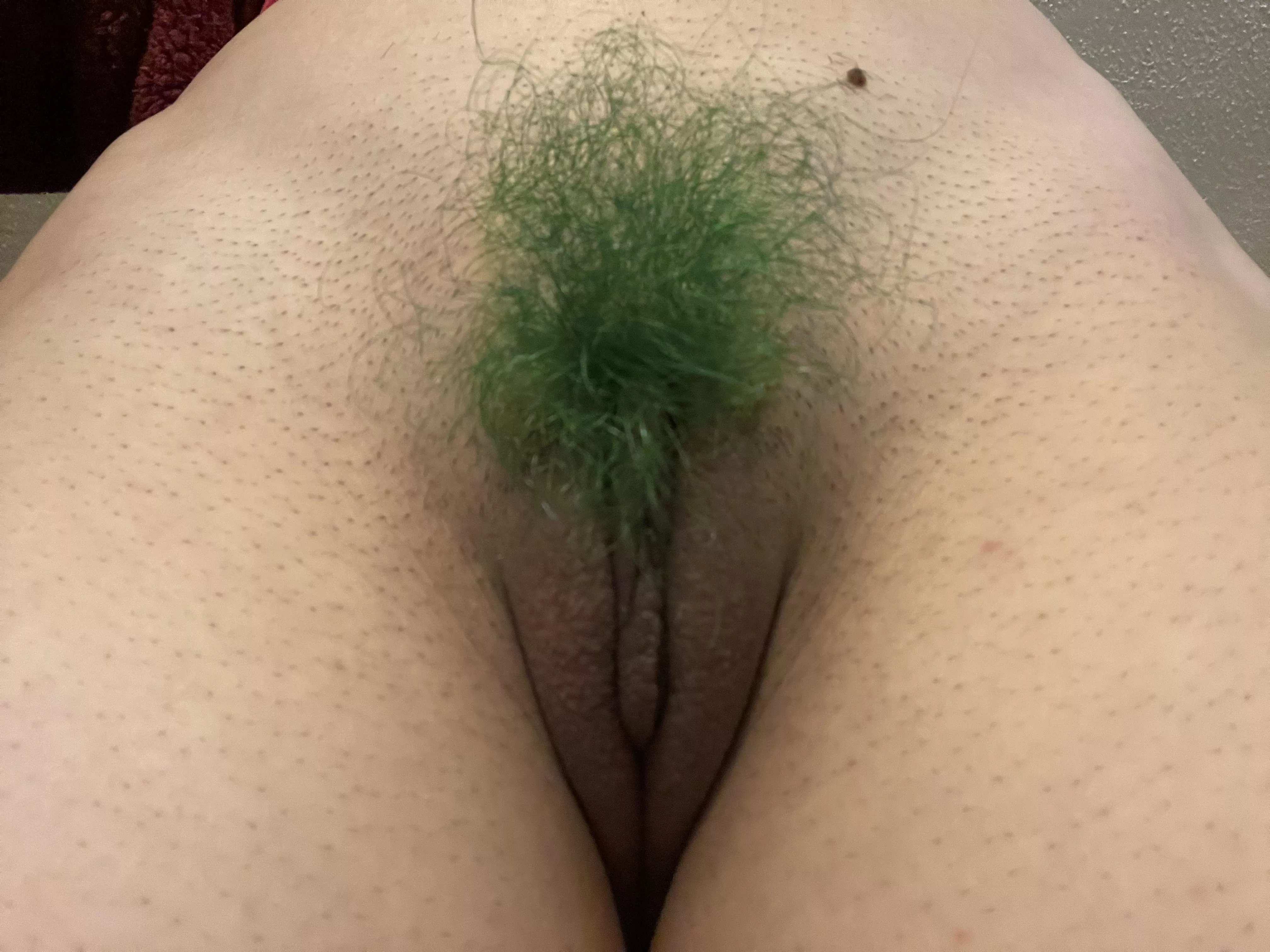 Nature and me both have green bushes! posted by lethallabia