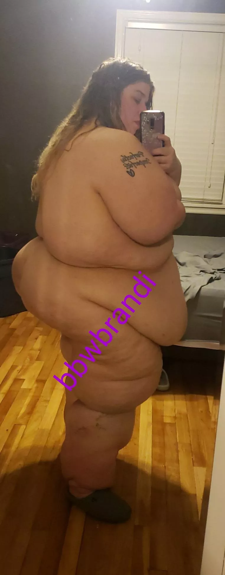 Need some loving on these legs posted by Snoo-47509