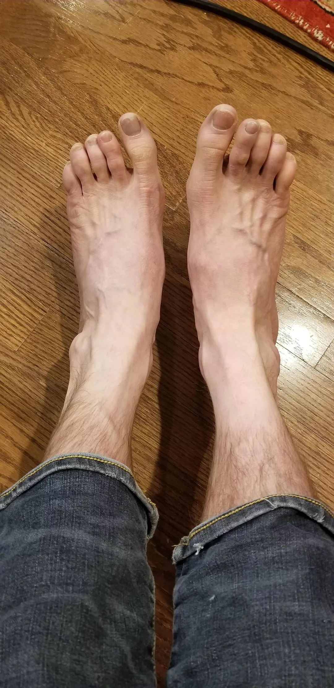 needed to let my feet air out a bit. posted by ShirtlessGinger