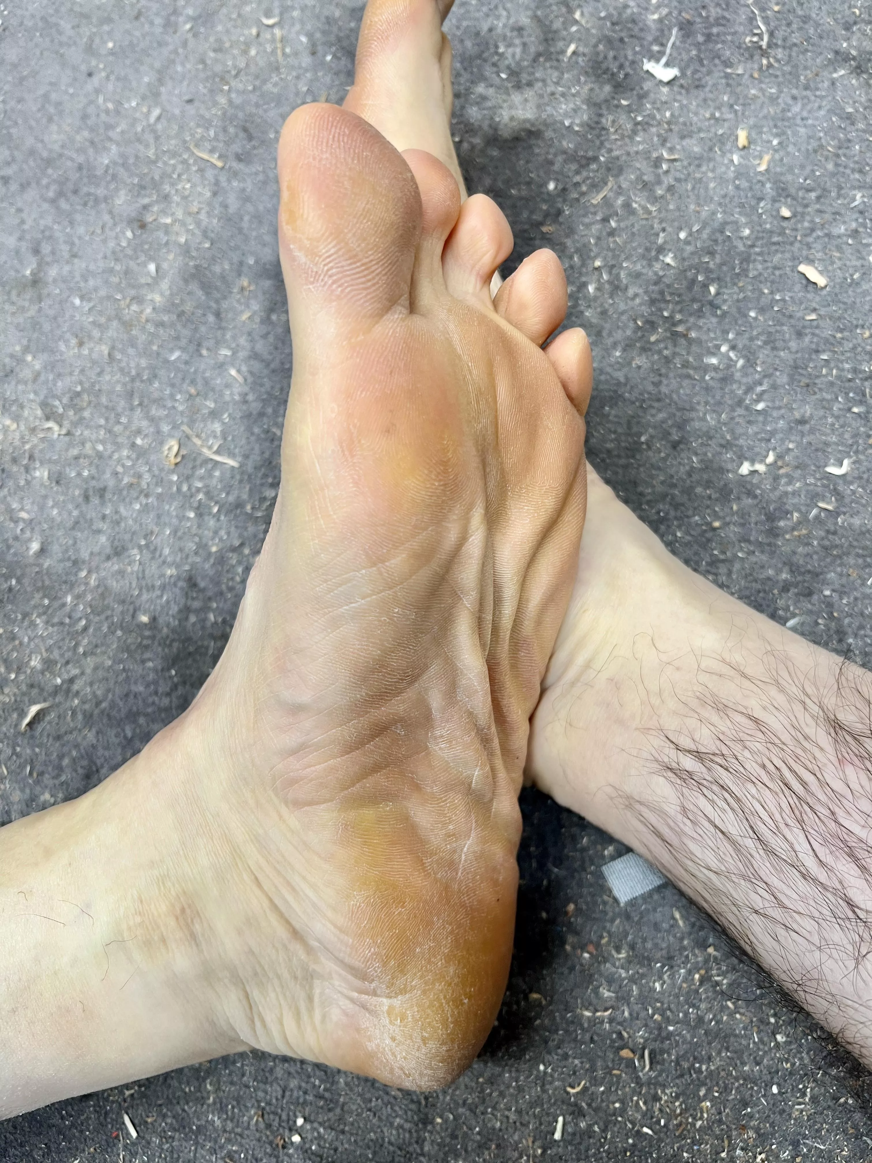 Needs some moisturizing posted by hmmcock