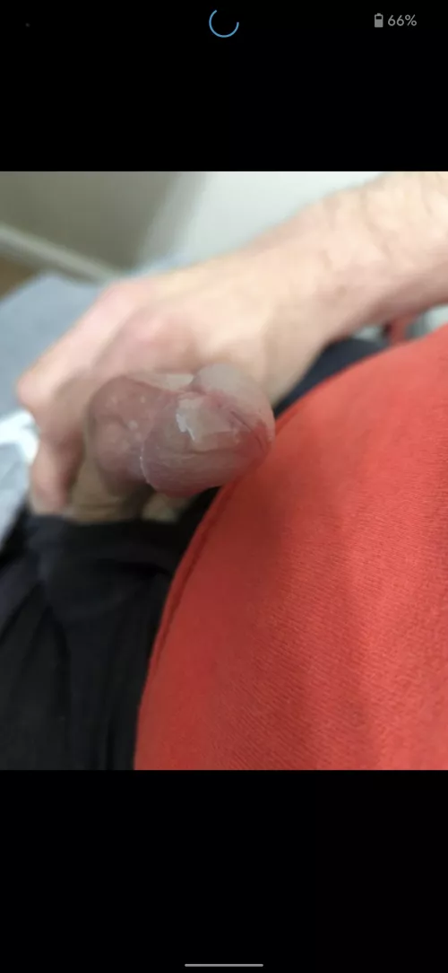 Not even sure how it happens by Flat_Debate