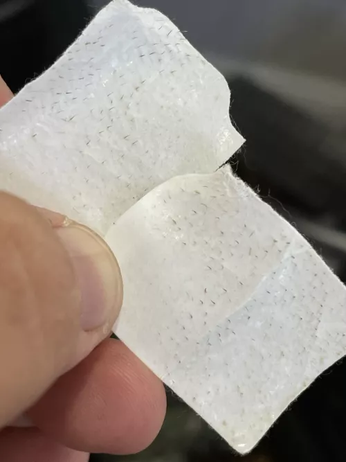 Not popping but thought you might appreciate. From my cheeks under my eyes, next to my nose. by animus_desit