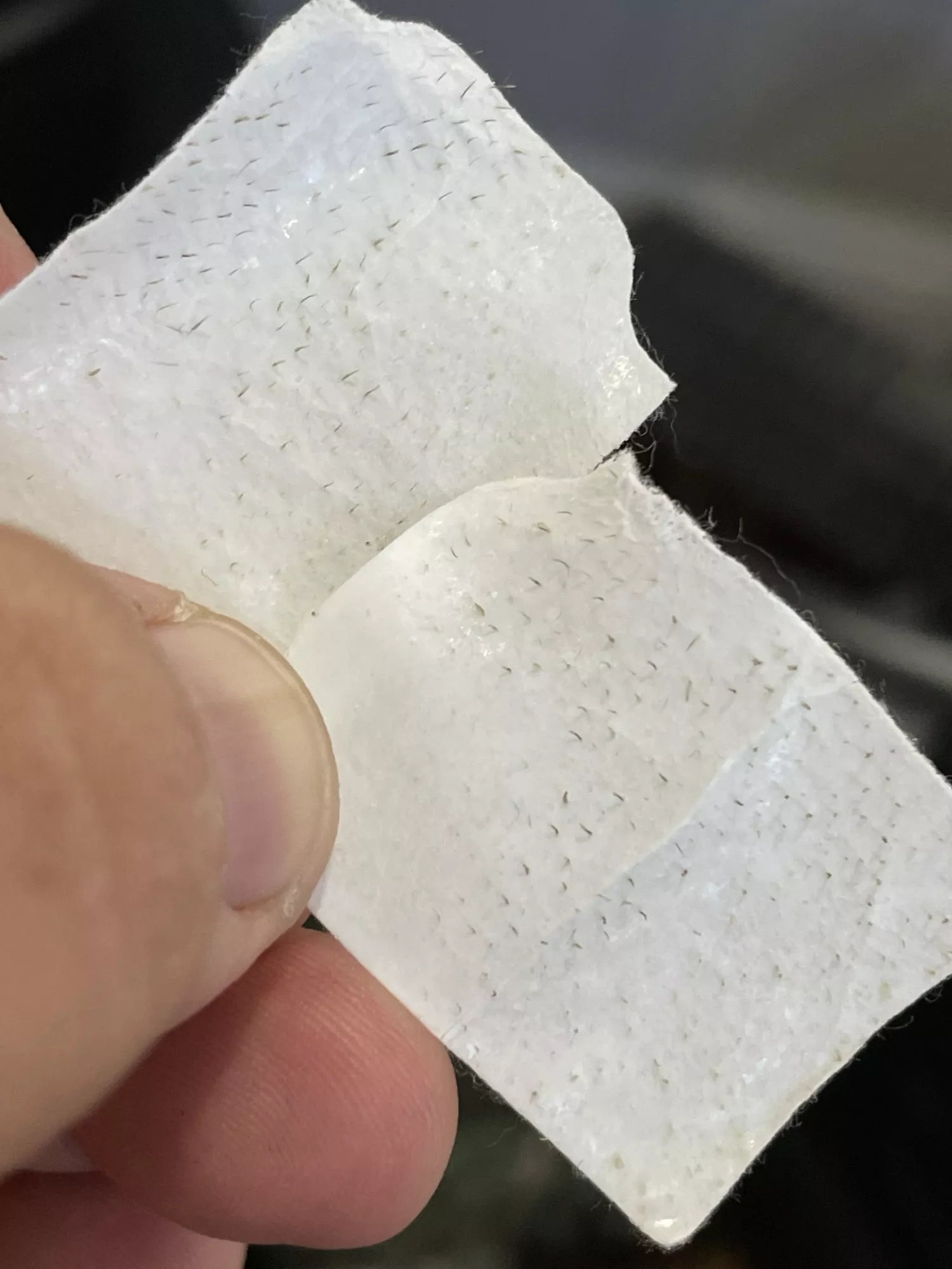 Not popping but thought you might appreciate. From my cheeks under my eyes, next to my nose. posted by animus_desit