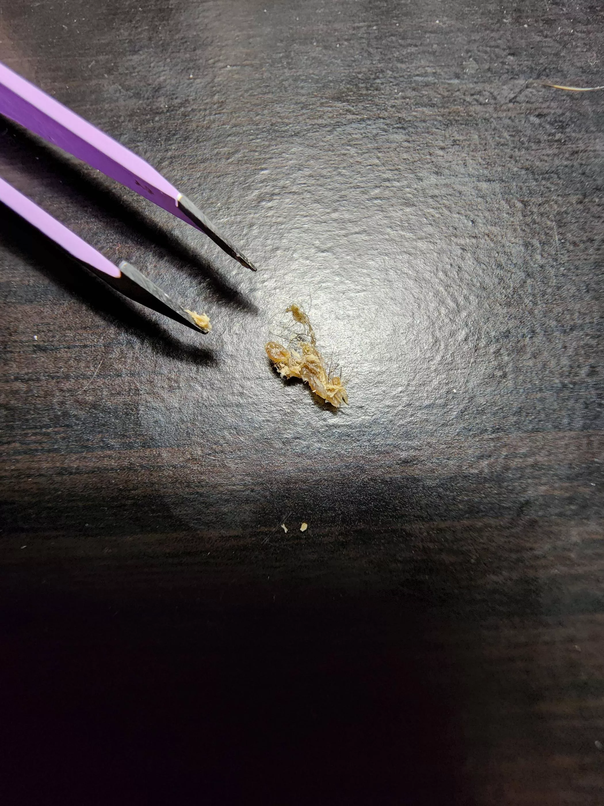 Not sure if this fits in this subreddit, but my wife just pulled this monstrosity out of my belly button posted by phero1190
