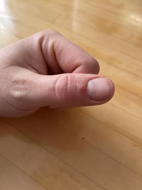 Not sure what’s going on here. Assuming there’s a splinter. Nothing happens when I squeeze. Any advice to prime this thing to score some sick popping footage? by rizzo1717