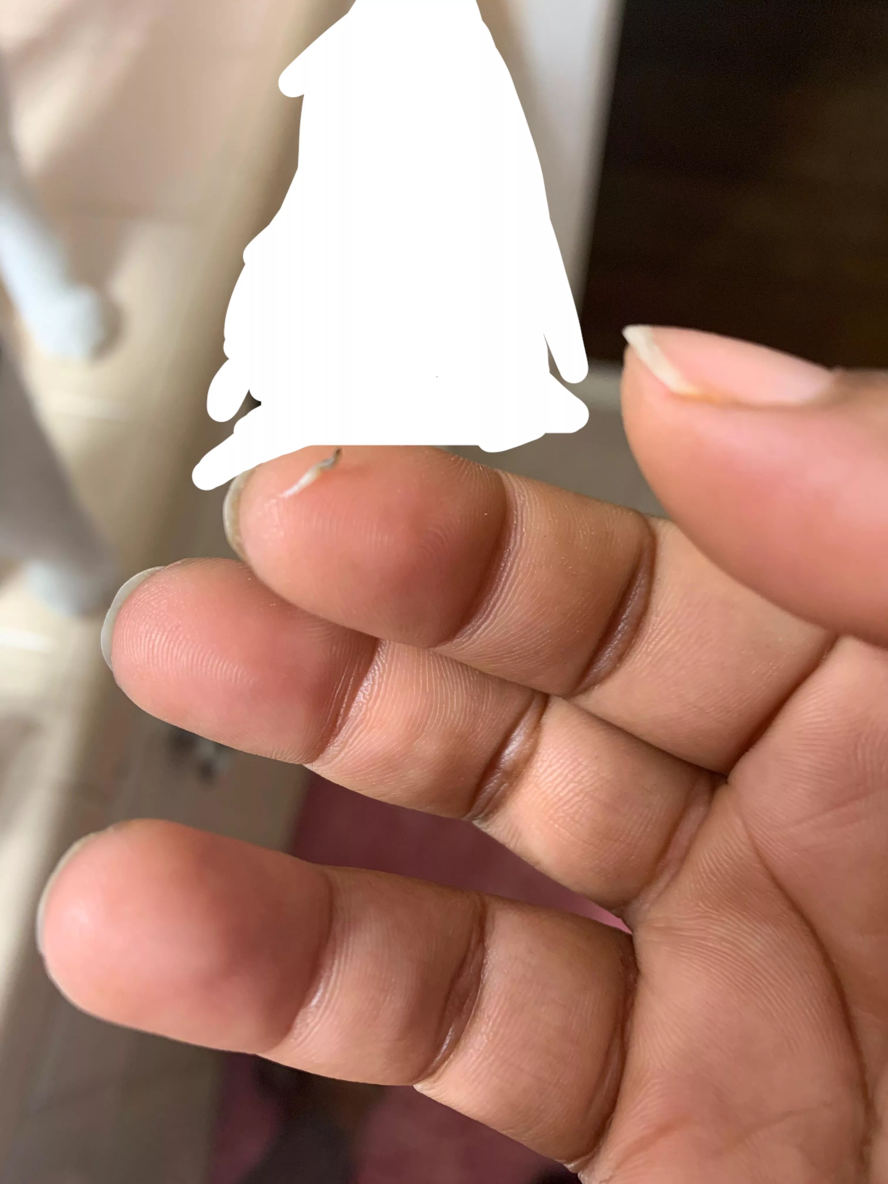 OC underwhelming pop with surprising result. Is this a blackhead? Came from my armpit. (Sorry no video, I squeezed without thinking anything was really going to come out) posted by Alyxandrax