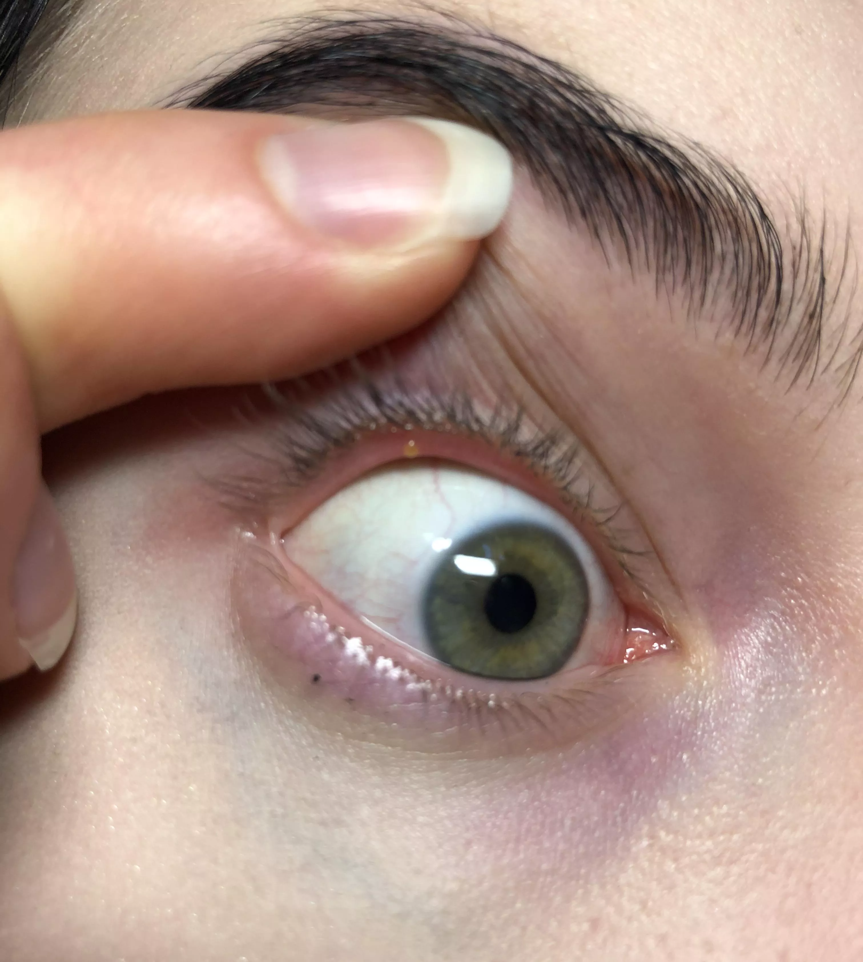 Of course this mf appears right before an important event so I can’t wear contacts or makeup. posted by let_me_hear_you_moan