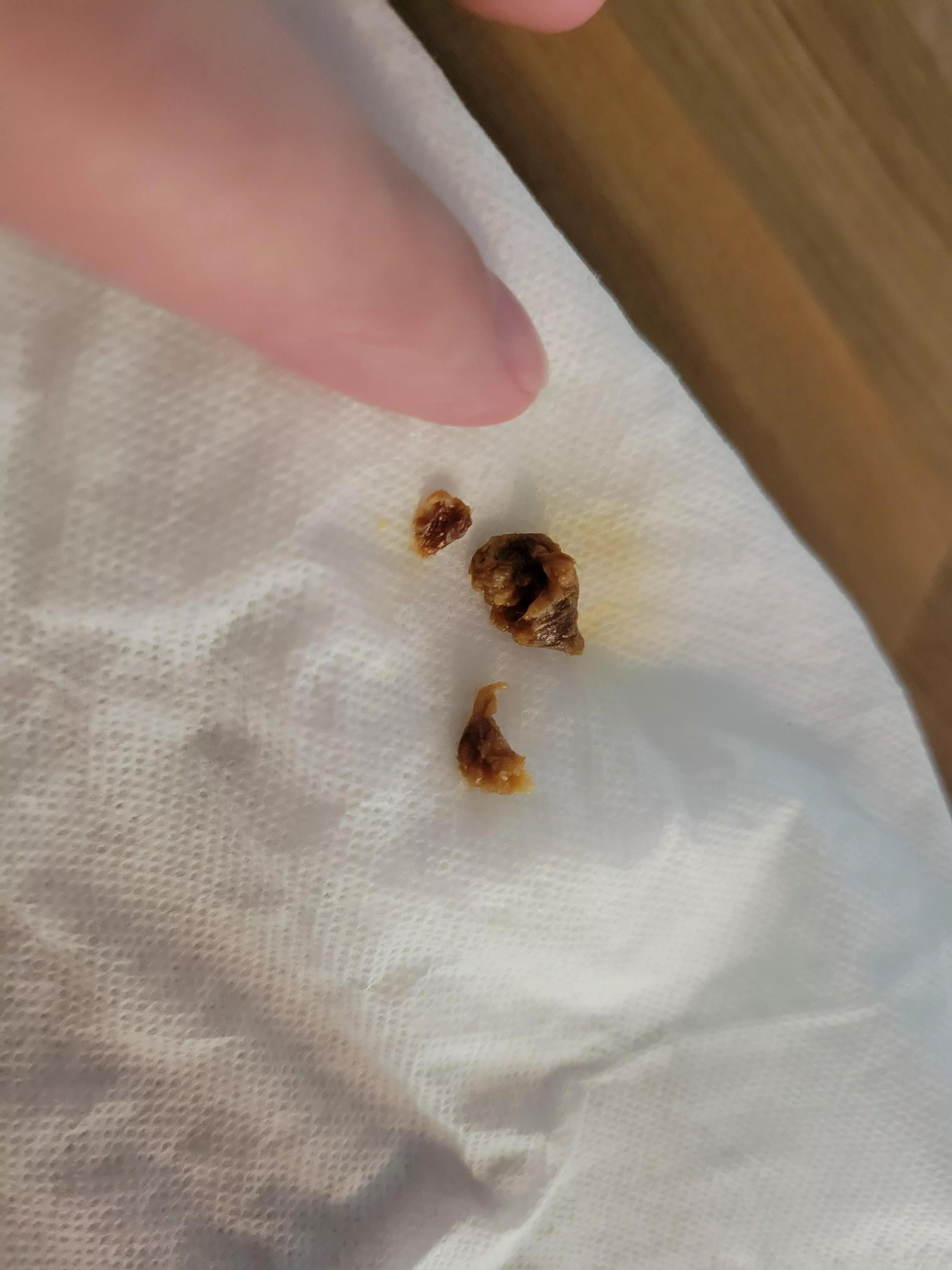 omg I can finally hear again out my right ear! posted by leogal304