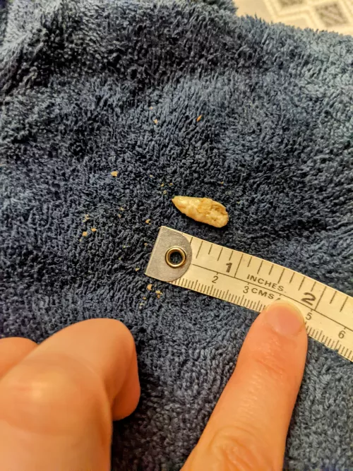 Omphalolith: I wish my body didn't do gross stuff :( by ToughHaunting