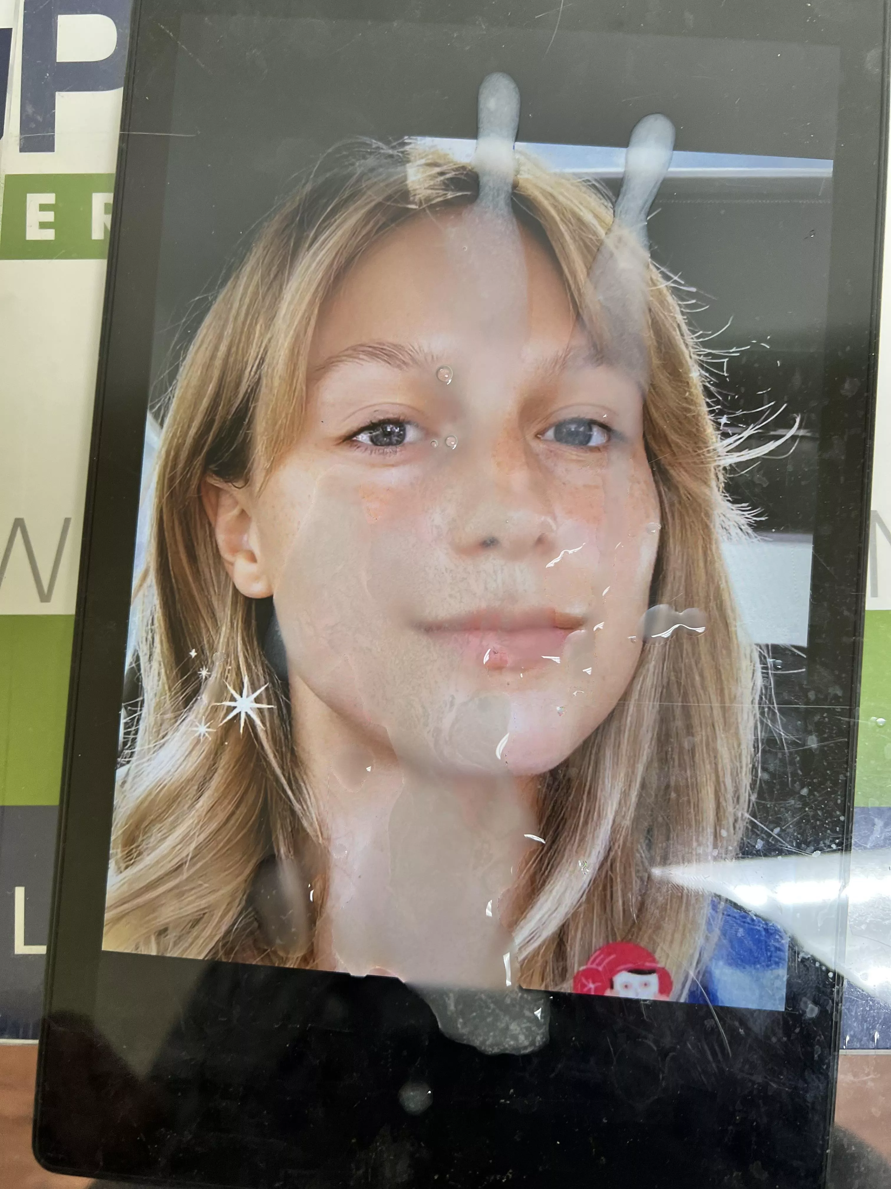 On Melissa Benoist's freckles! posted by merbs88