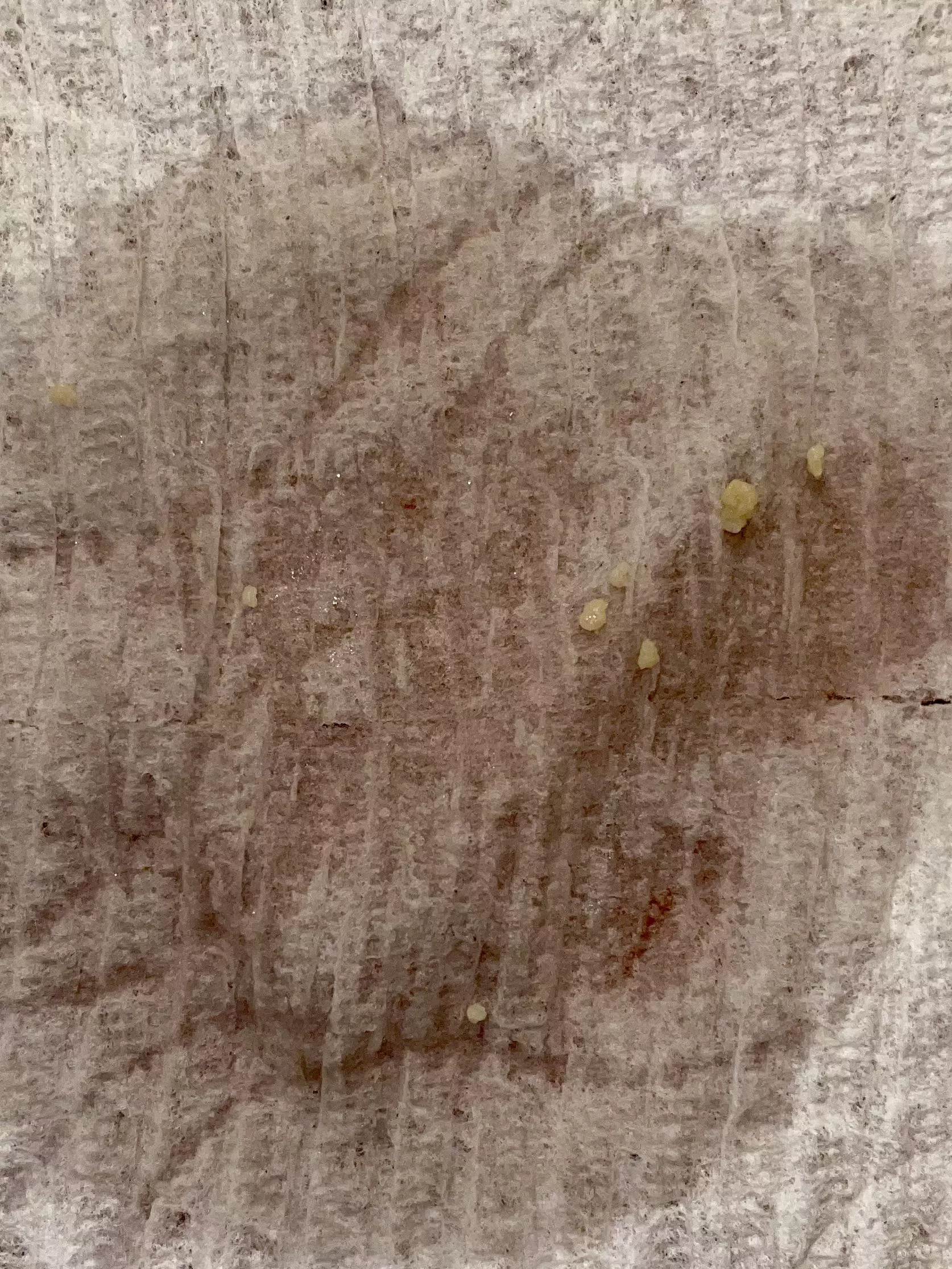 One sneeze. Eight stones (well, actually 9, but one was out of frame). Feels like I lost a pound. posted by ElleQ_4657