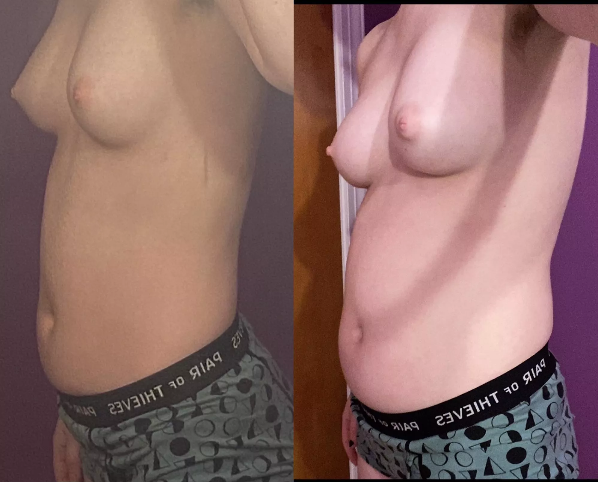 only a month and a half between these pics. u can imagine how much eating ive done..😵 posted by mazokizumi