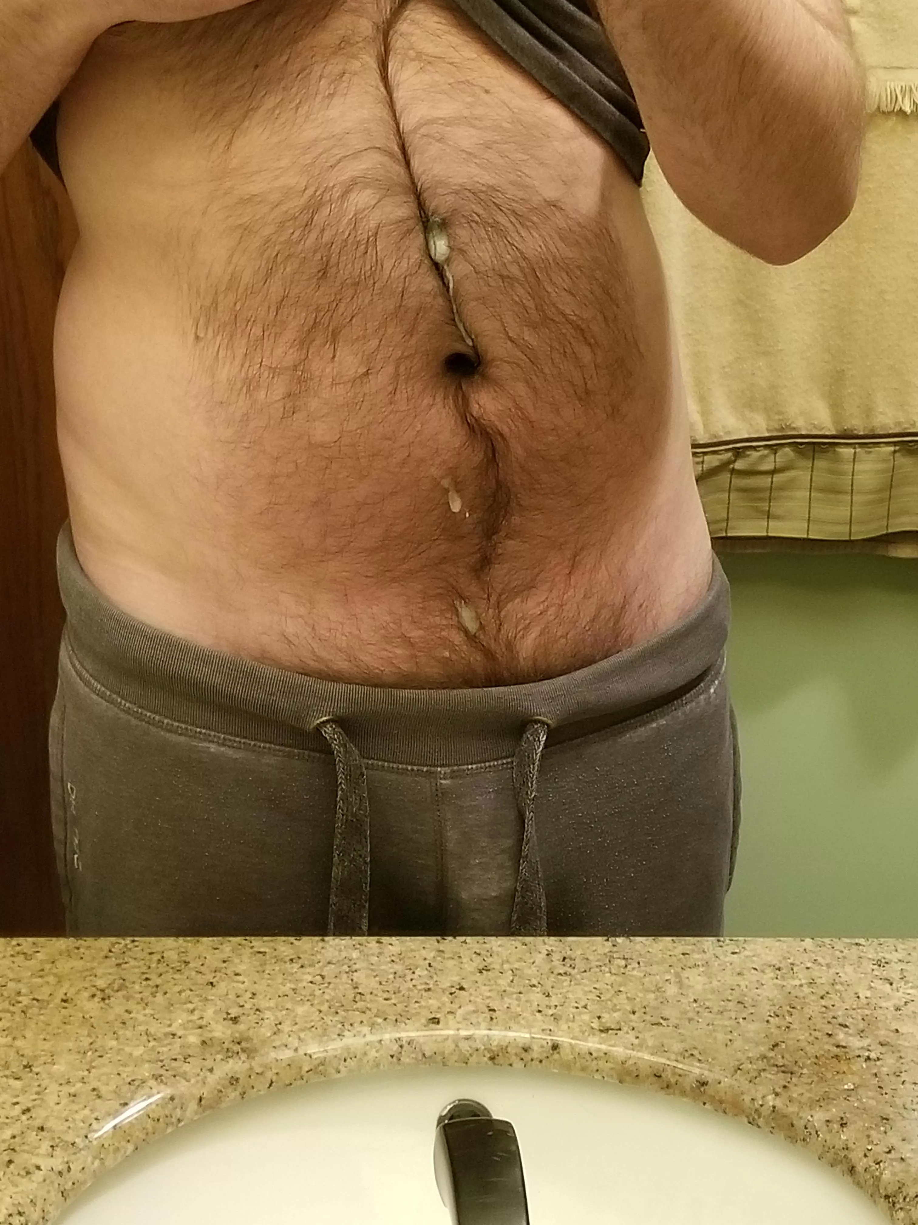 Oops posted by memoryisfuzzy