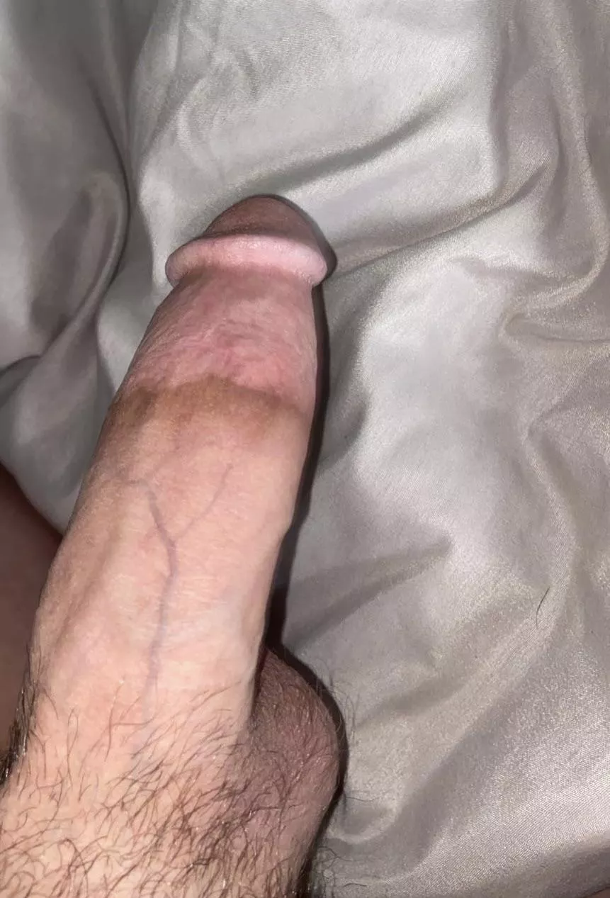 Open up posted by NewAdditions