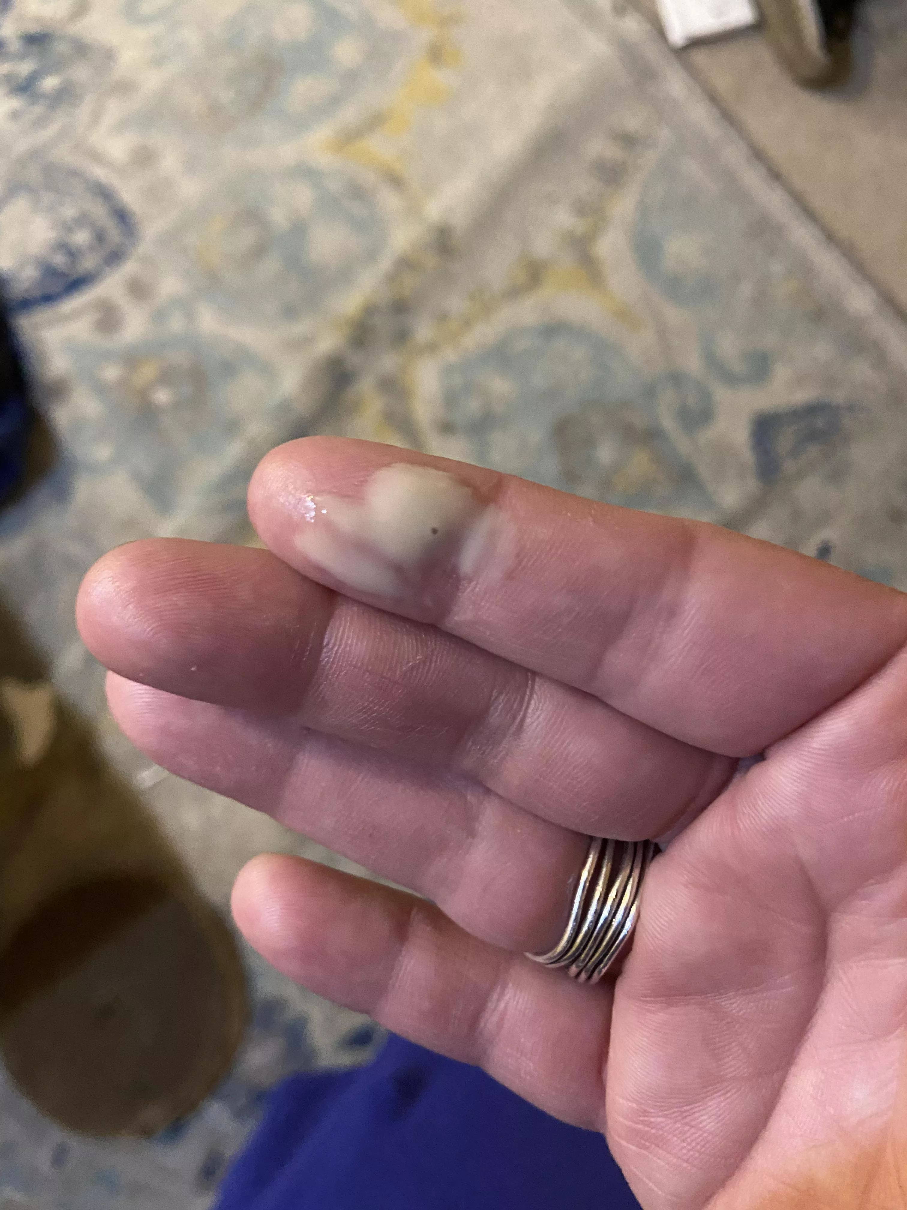 Painful upper thigh pop. posted by catbehindbars