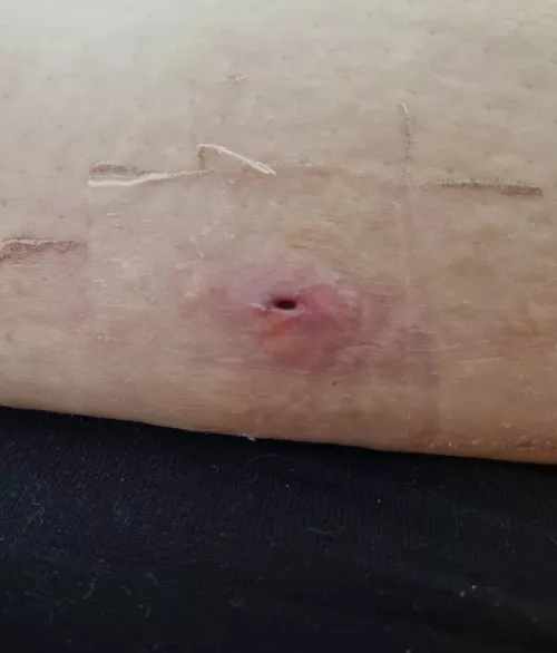 Photo only, sorry about that. But I thought this gaper on my side might still be worth showing. by Popping-account