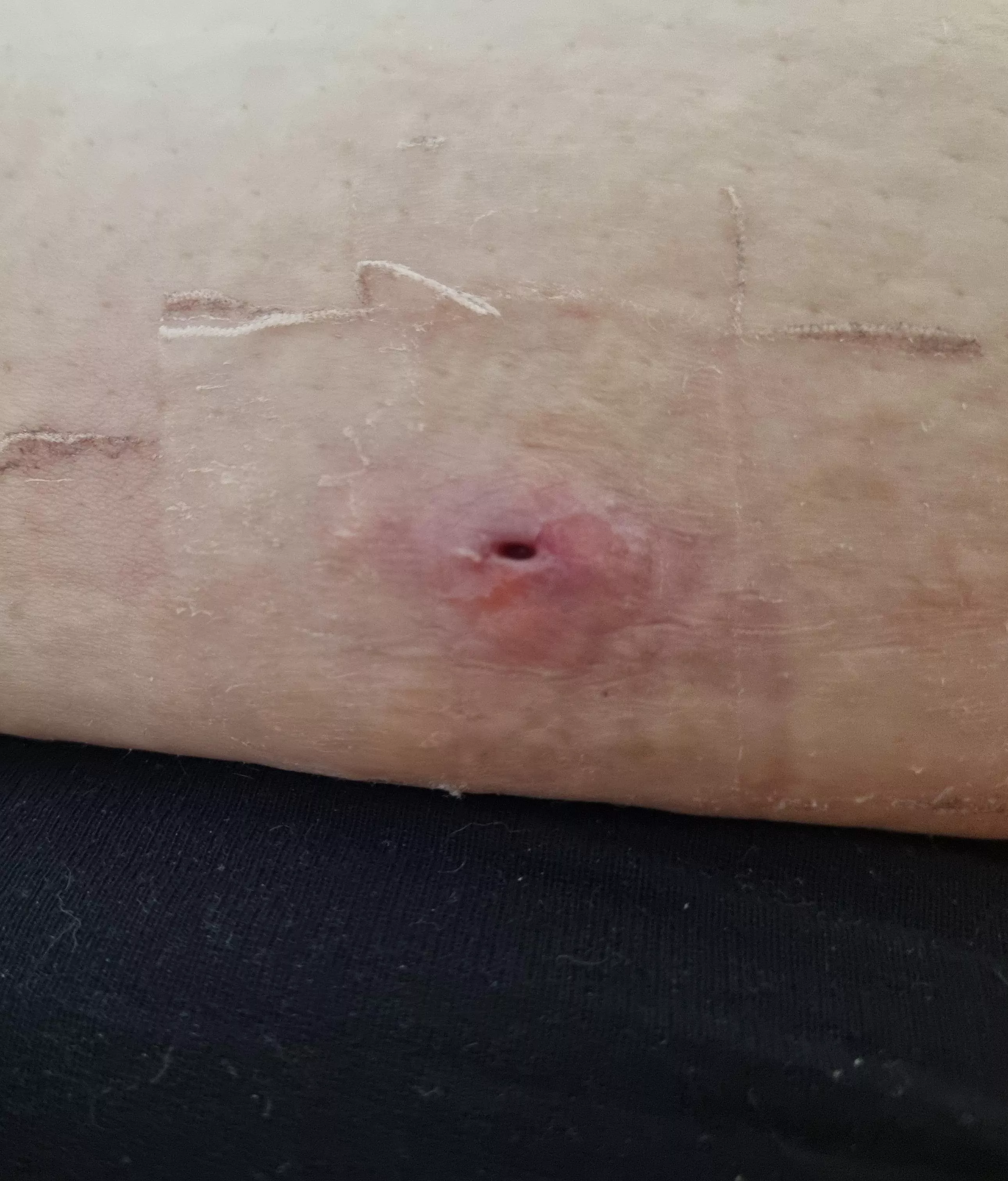 Photo only, sorry about that. But I thought this gaper on my side might still be worth showing. posted by Popping-account