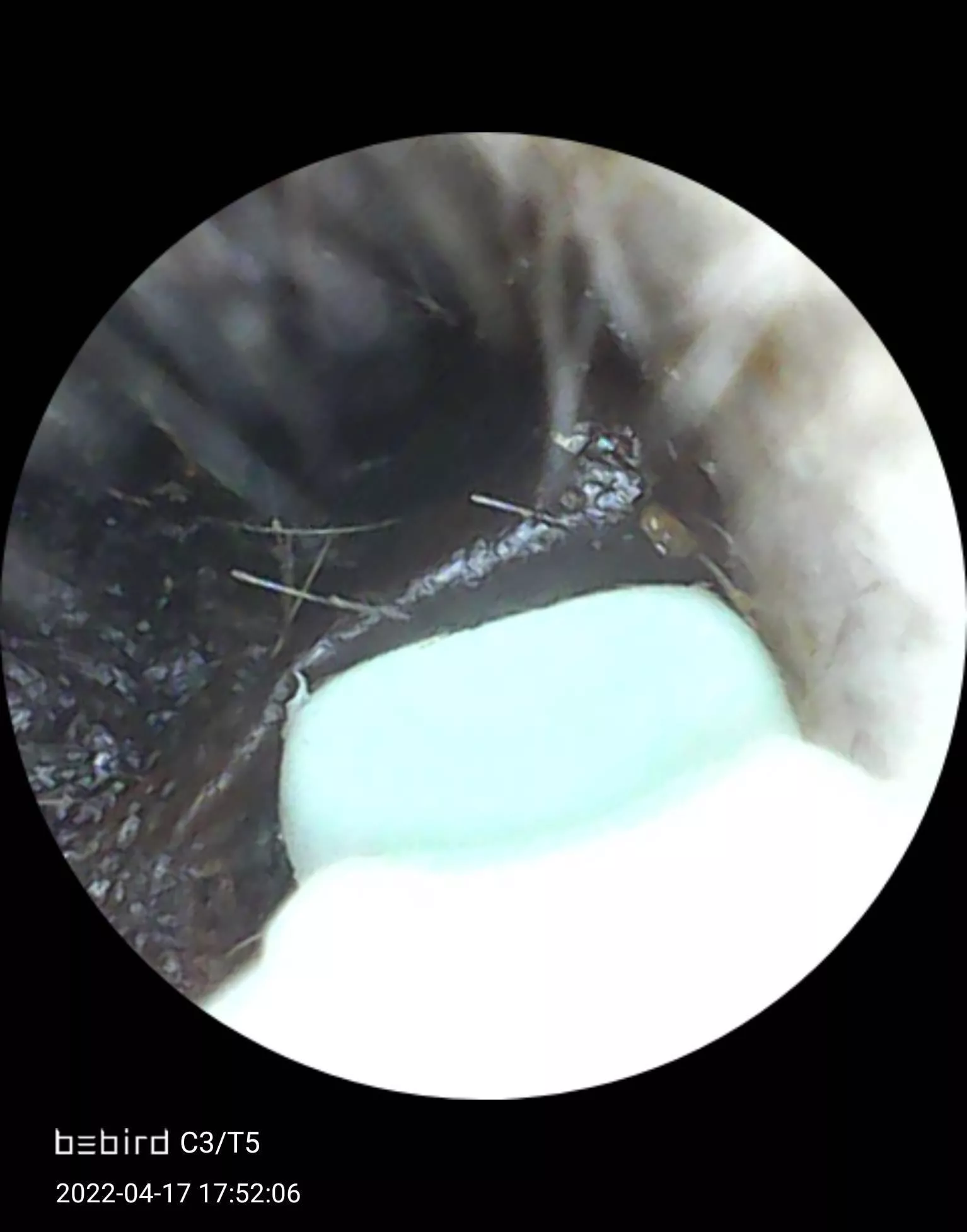 [PIC] Found this goldmine of wax in my husbands ear yesterday, then camera died. Charged today, mining after dinner, video to come! posted by WittyKittyBoom