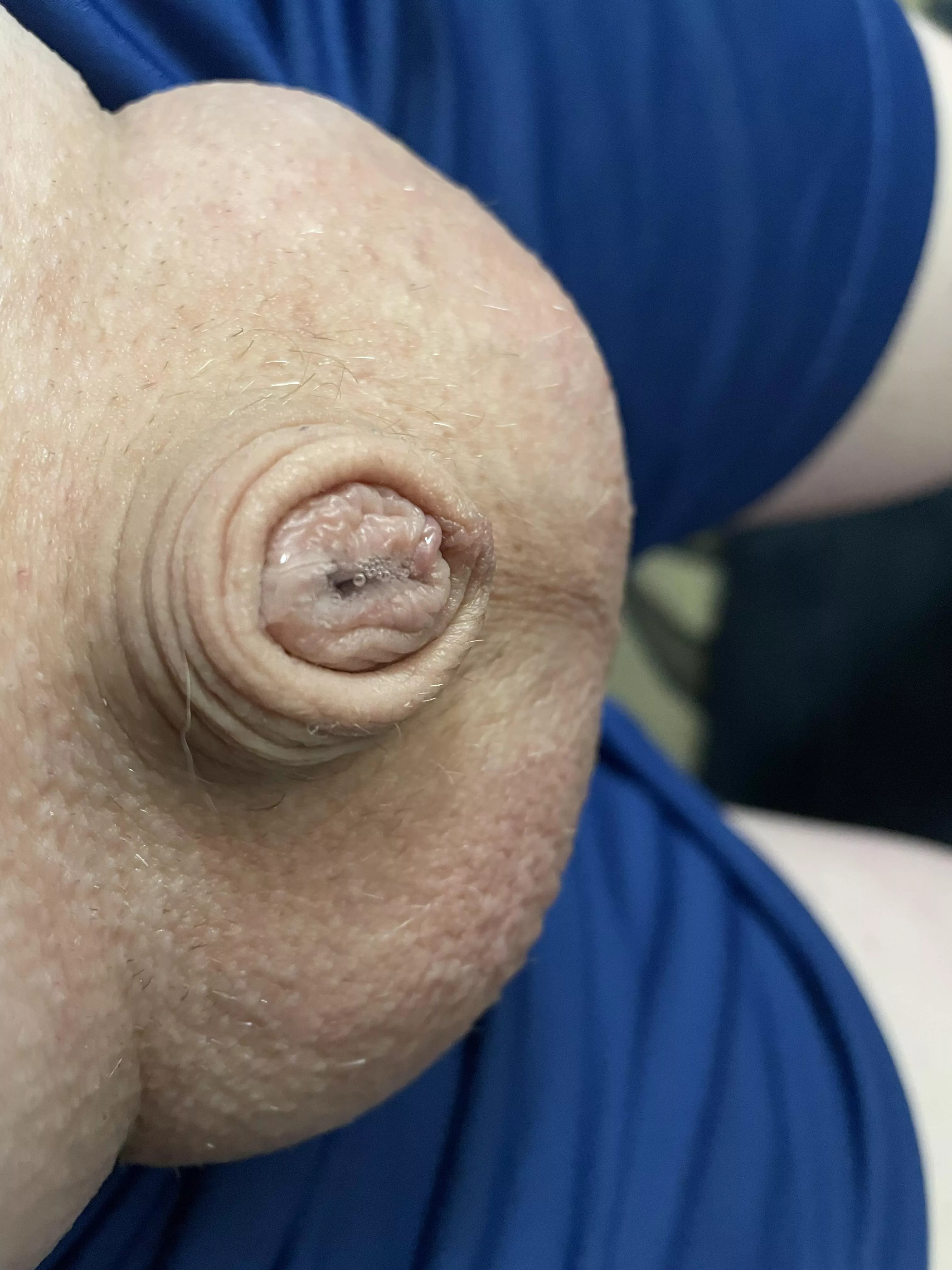 Pooling (40) posted by Friendly-Jacket-1793