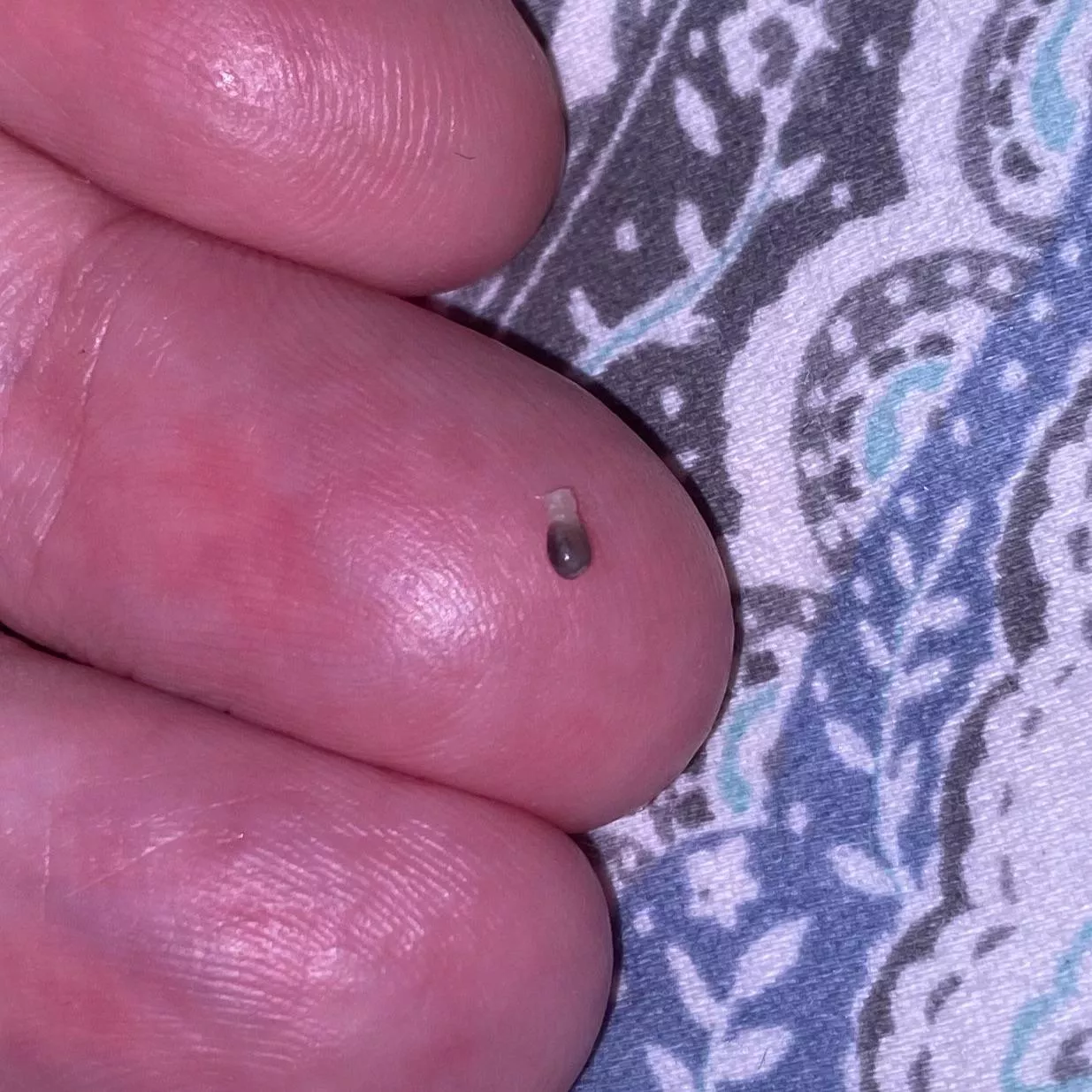 Popped this weird pellet out of an angry pimple on the back of my thigh posted by AdaladeKasner