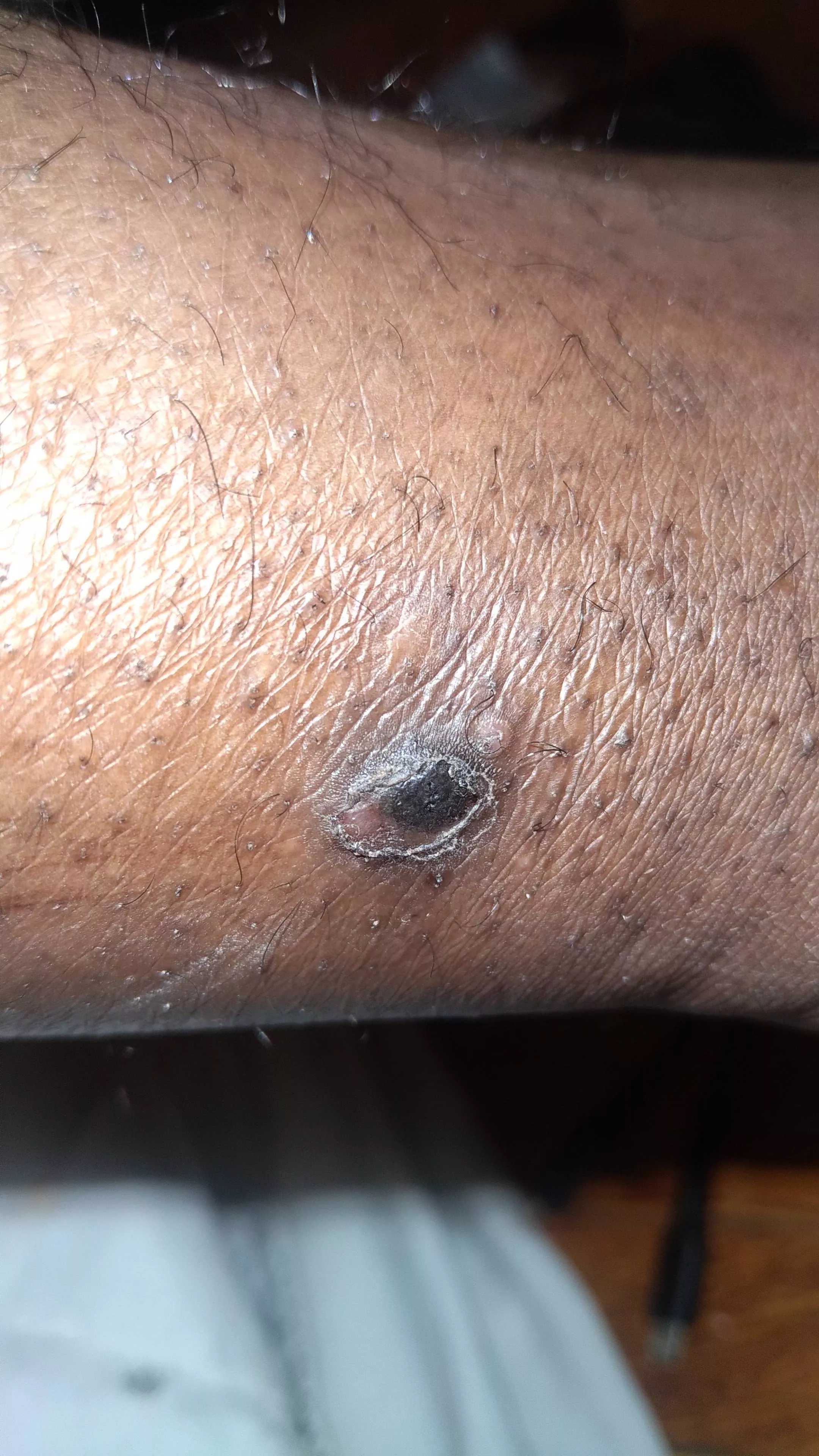 Posted previously here's how the bump currently looks posted by caseyscolumbusss