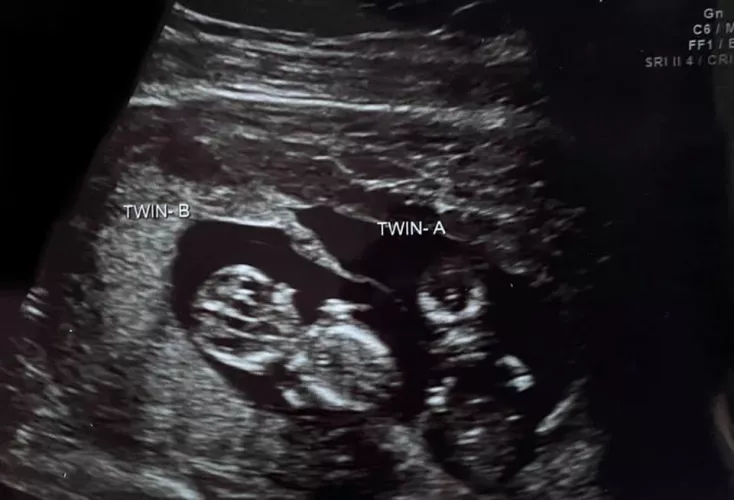 Pregnancy update in comments! by CuckCouple246