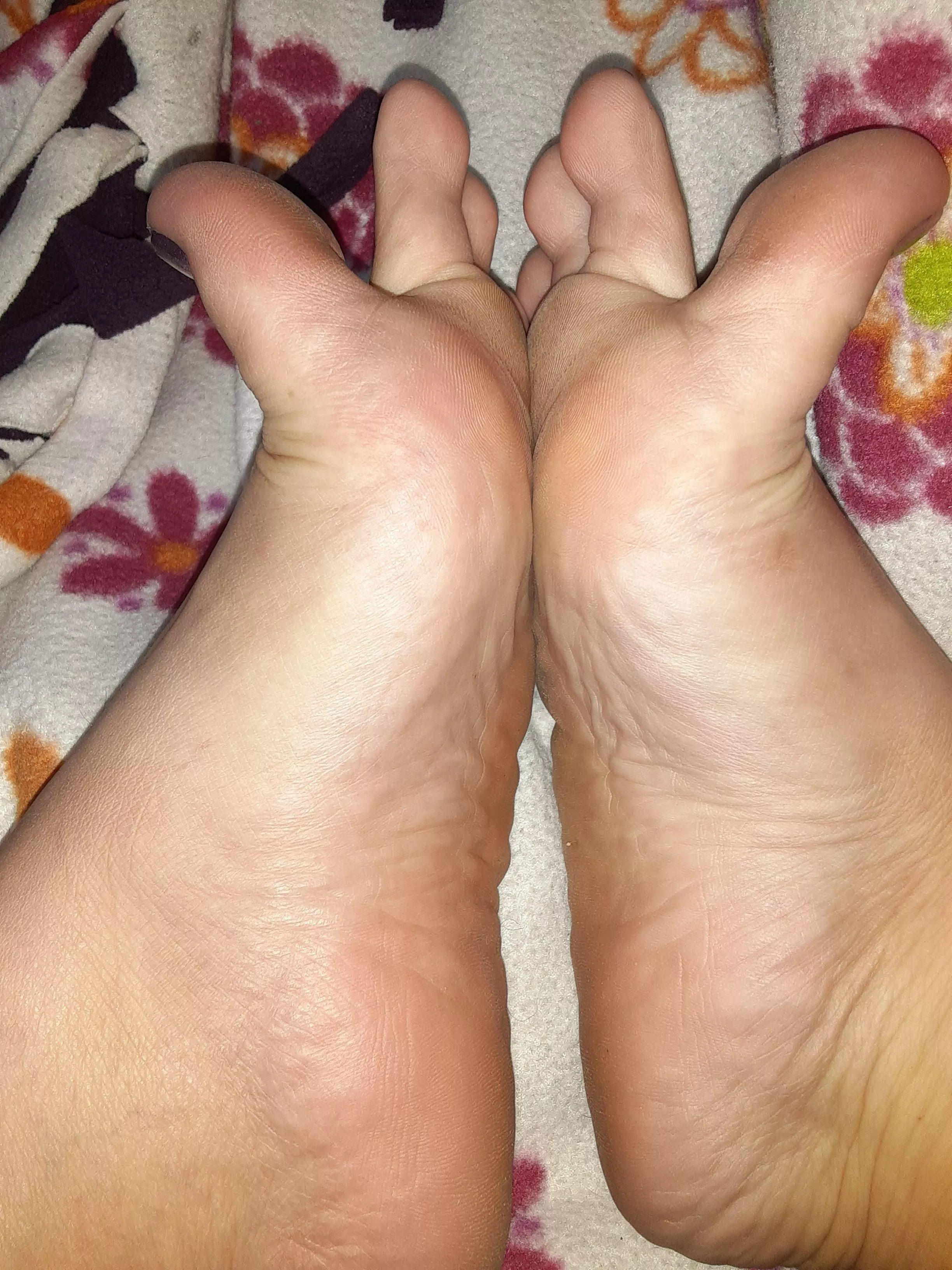 Pressed together posted by Responsible-Bad8387