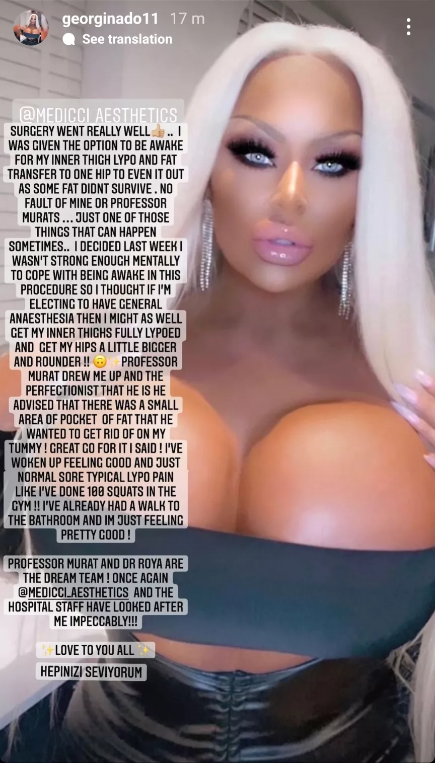 Proud of her surgeries like a good bumbo posted by burger_boyuk