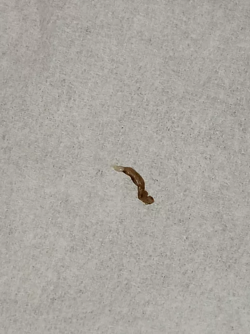 Pulled for Bikini line can't tell if big black head or little dpow; left a little hole behind by Kekebolt12