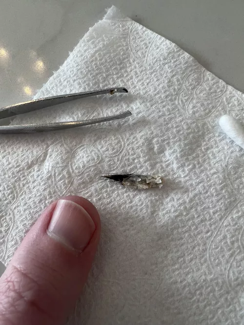 Pulled this out of my belly button this morning by mutantbabysnort