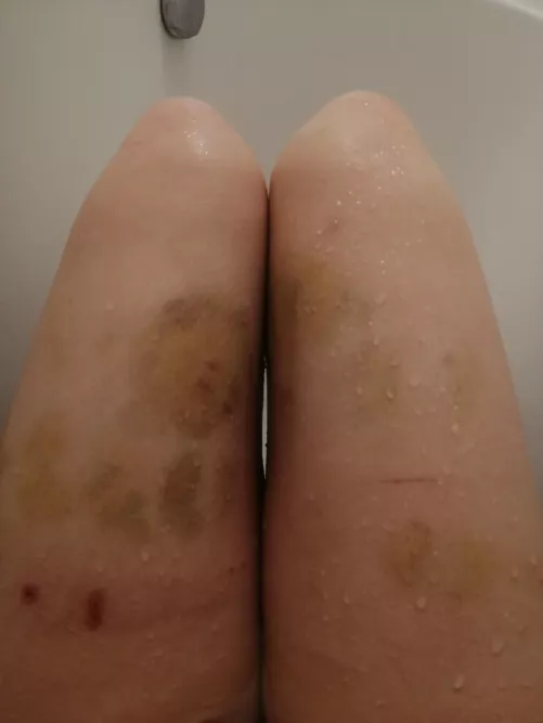 punishment aftermath by Forsaken_Resident_20