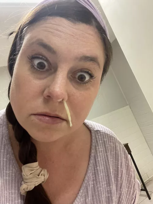 Pus is finally draining out after sinus surgery. by sdsalter