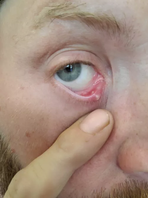 Quick update on the forbidden pop by nugletman