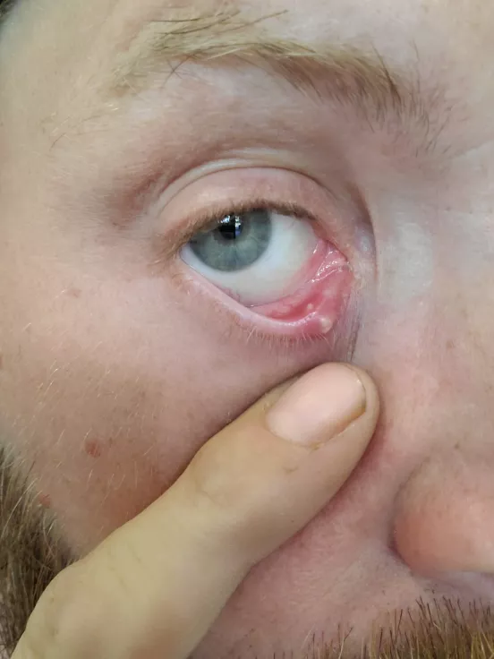 Quick update on the forbidden pop posted by nugletman