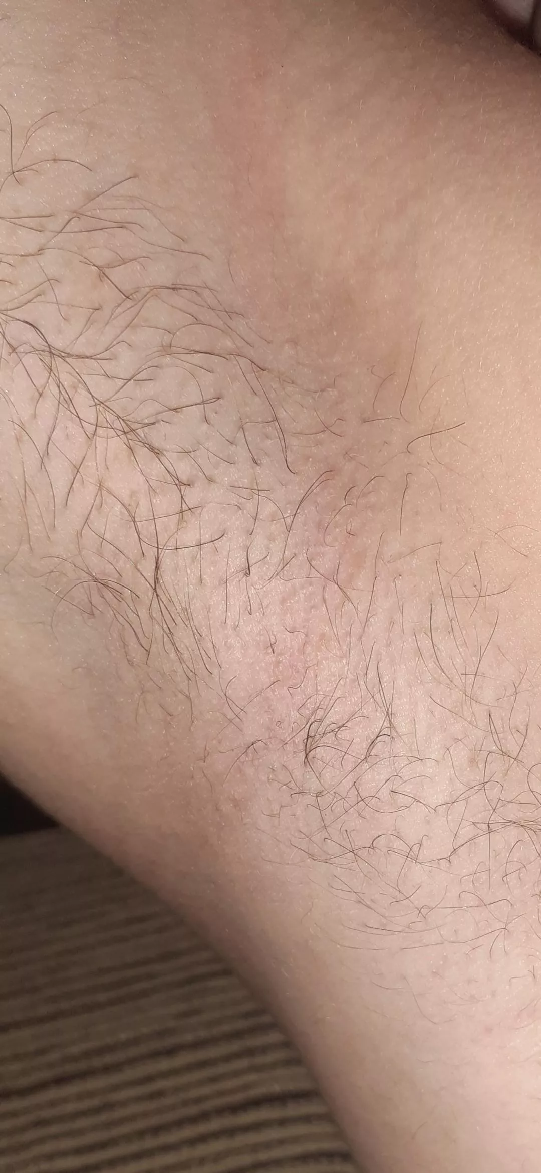 Rate my armpit! posted by usernic99