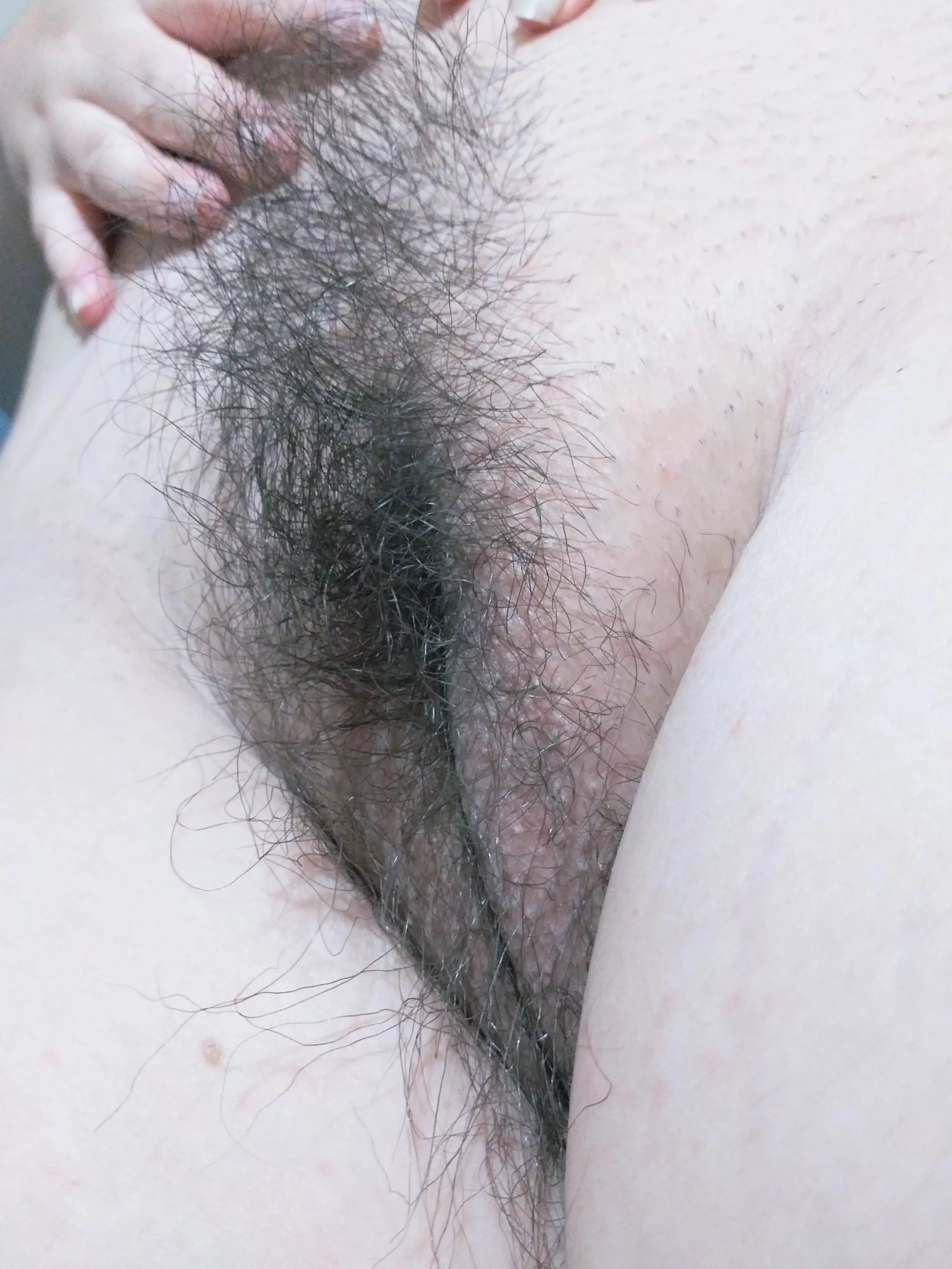 Rate my hairy? 🐱 posted by delightful-wafer