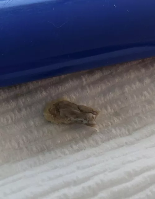 Removed from Hubby's ear Part 2 by Shannonmill