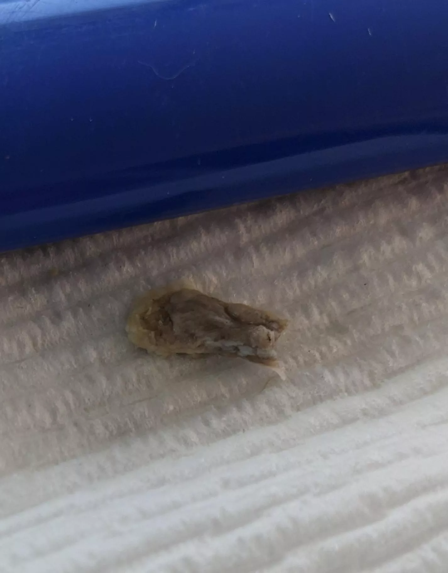 Removed from Hubby's ear Part 2 posted by Shannonmill