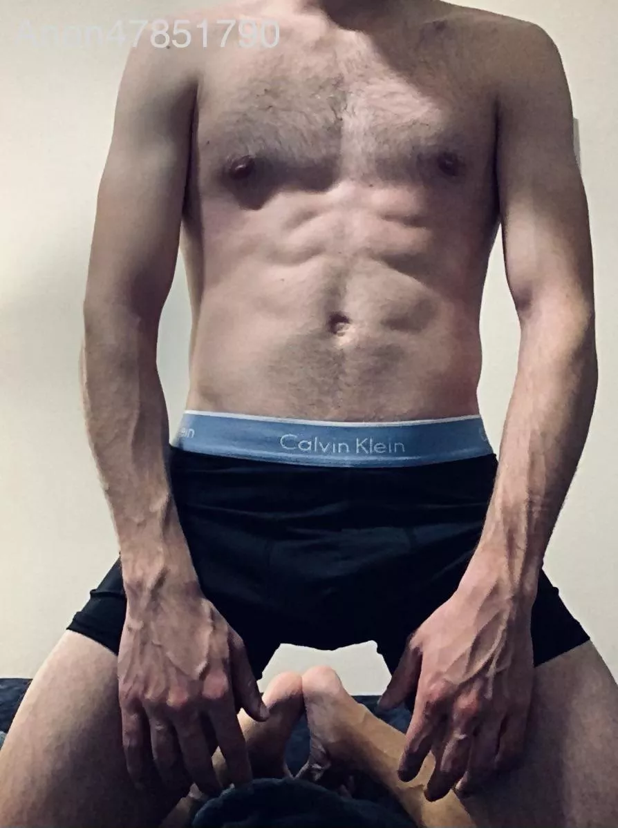 Riddled with veins posted by anon47851790