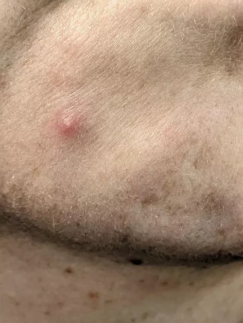 saving this chin one for y'all... coming soon by fmlish