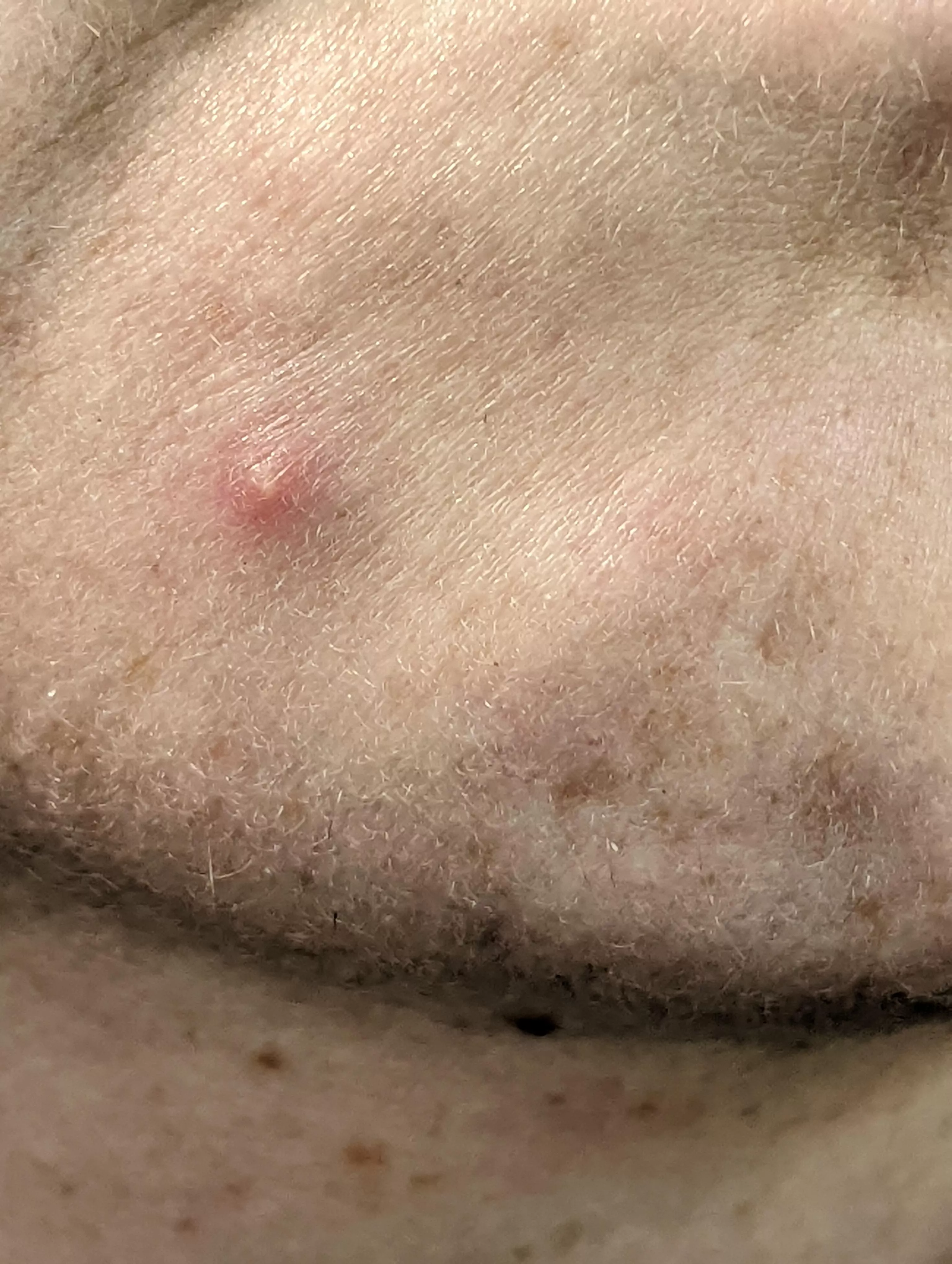 saving this chin one for y'all... coming soon posted by fmlish