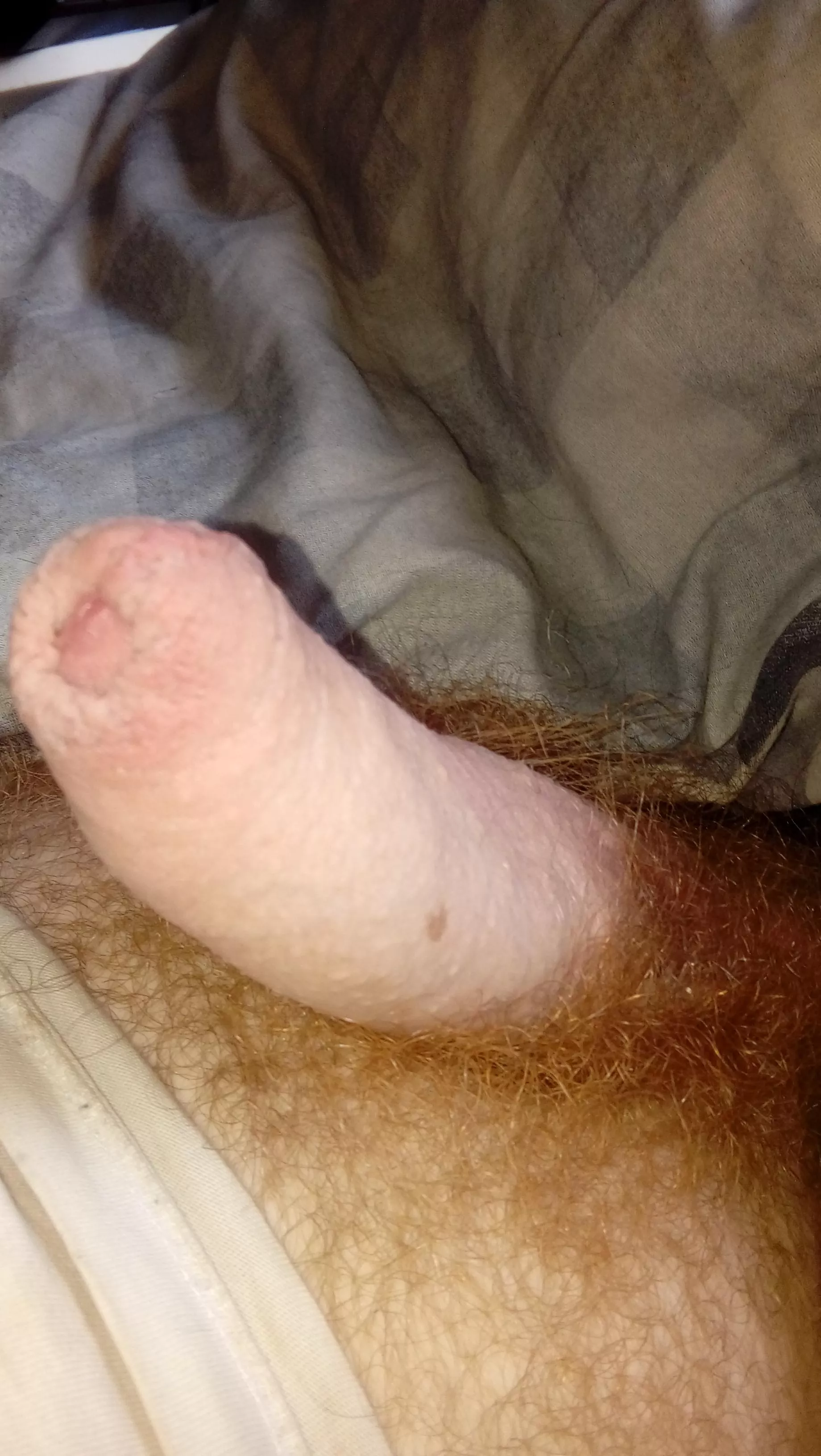 Scottish and ginger: ) (sorry about the freckle) posted by Tbhidklol64