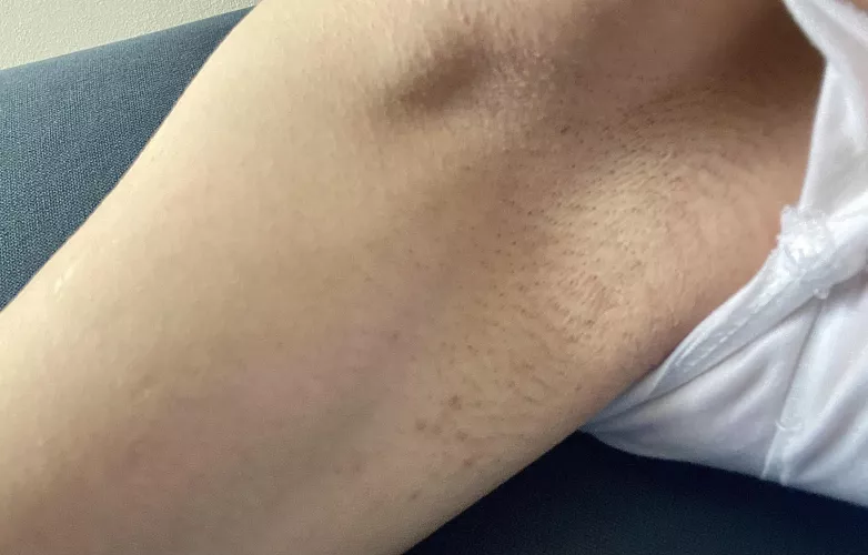 Shaved this morning, already stubbly 😅 by sunnypits