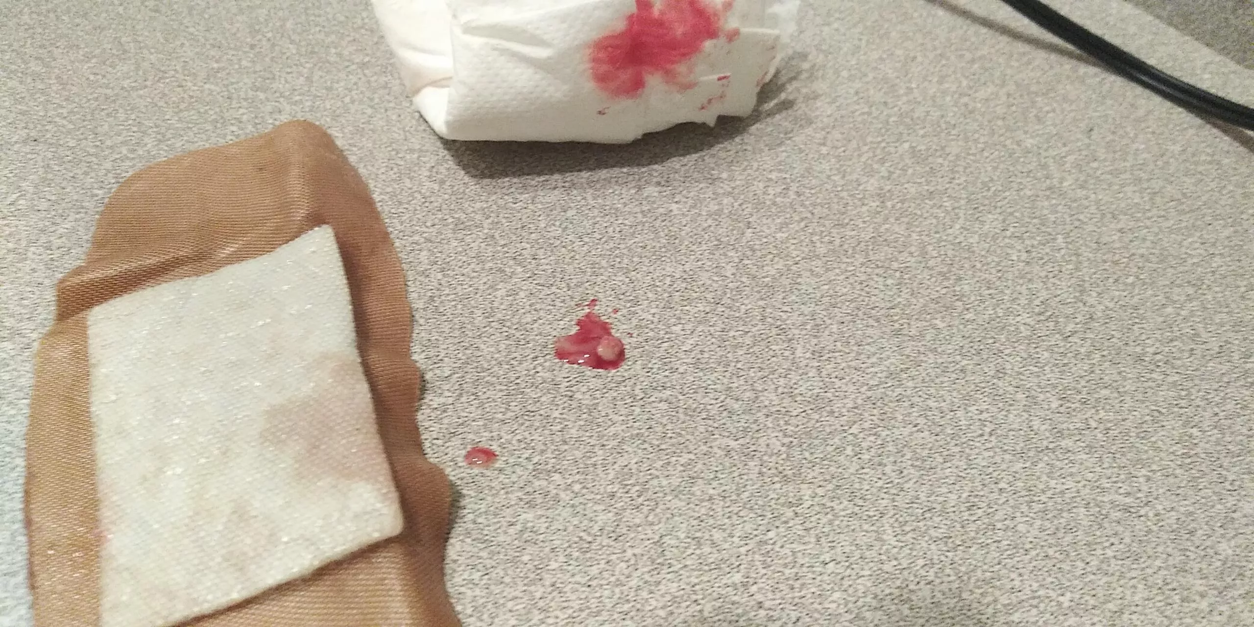 Shot a Small Chunk Out from Under My Arm posted by jabba-du-hutt