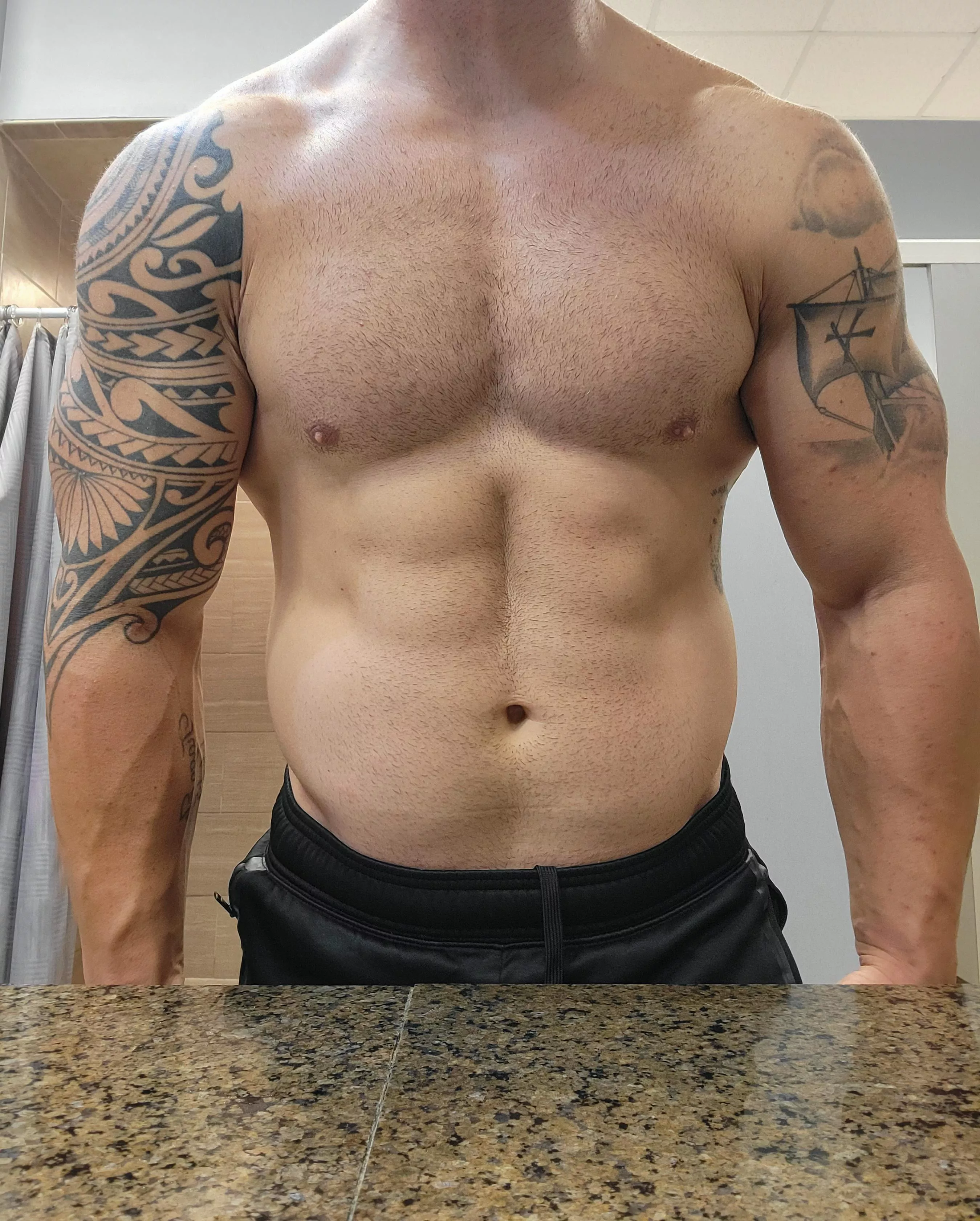 Should I get more? posted by Illustrious_Dentist6