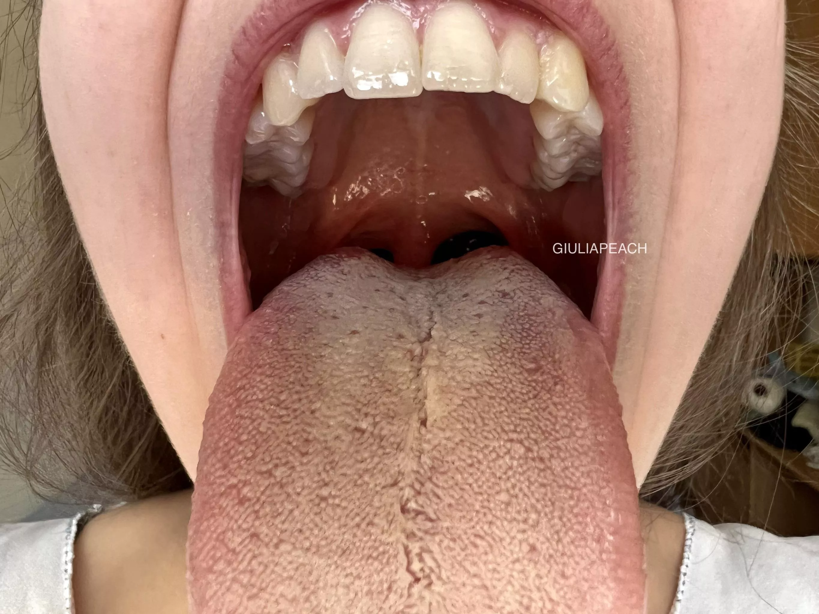 Should I go deeper? posted by giuliapeach