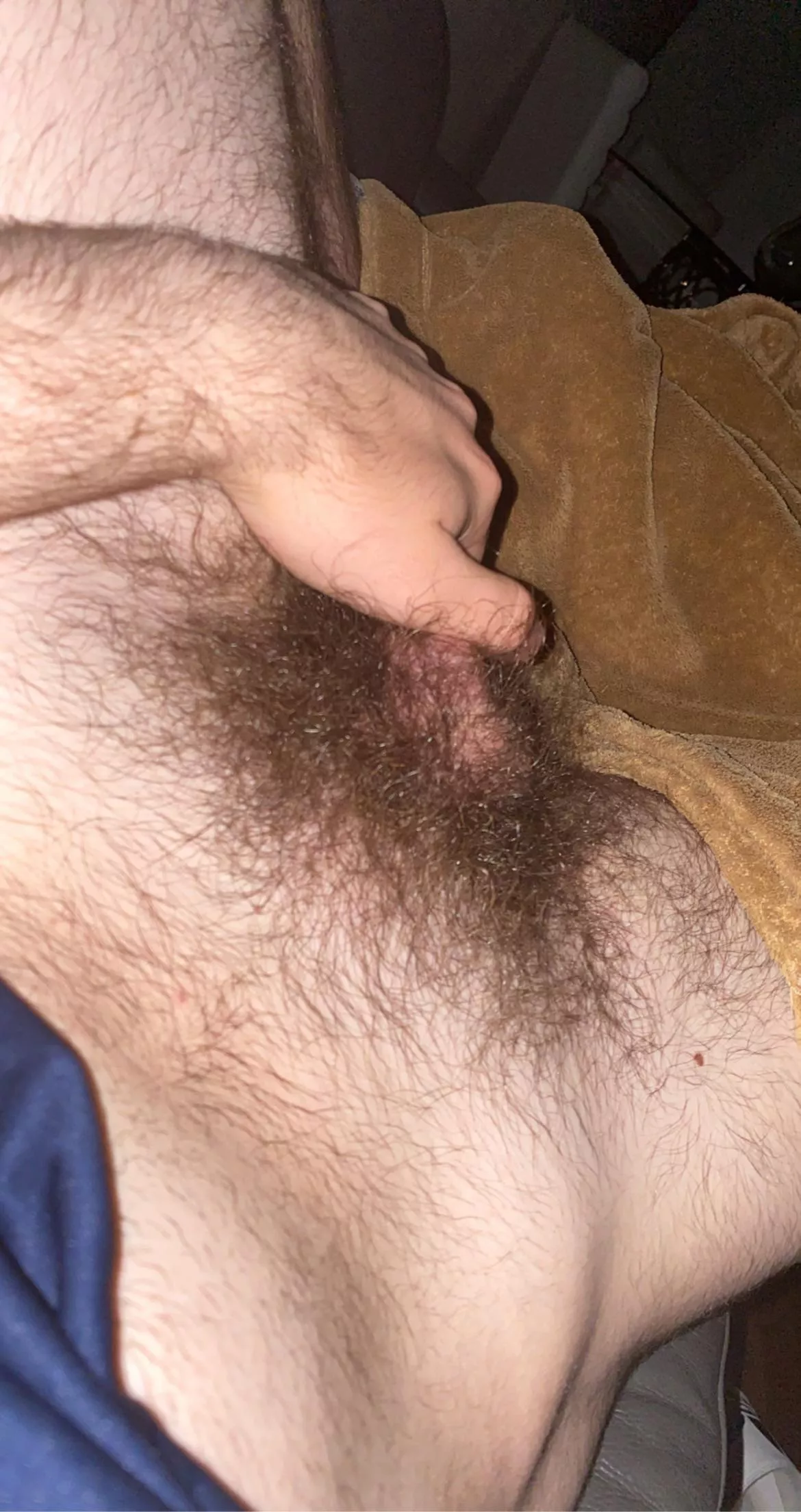 should I shave them? posted by hairyteen01